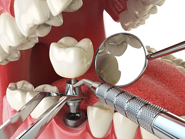 Best Emergency Dental Care for Sports Injuries in Matheny, CA